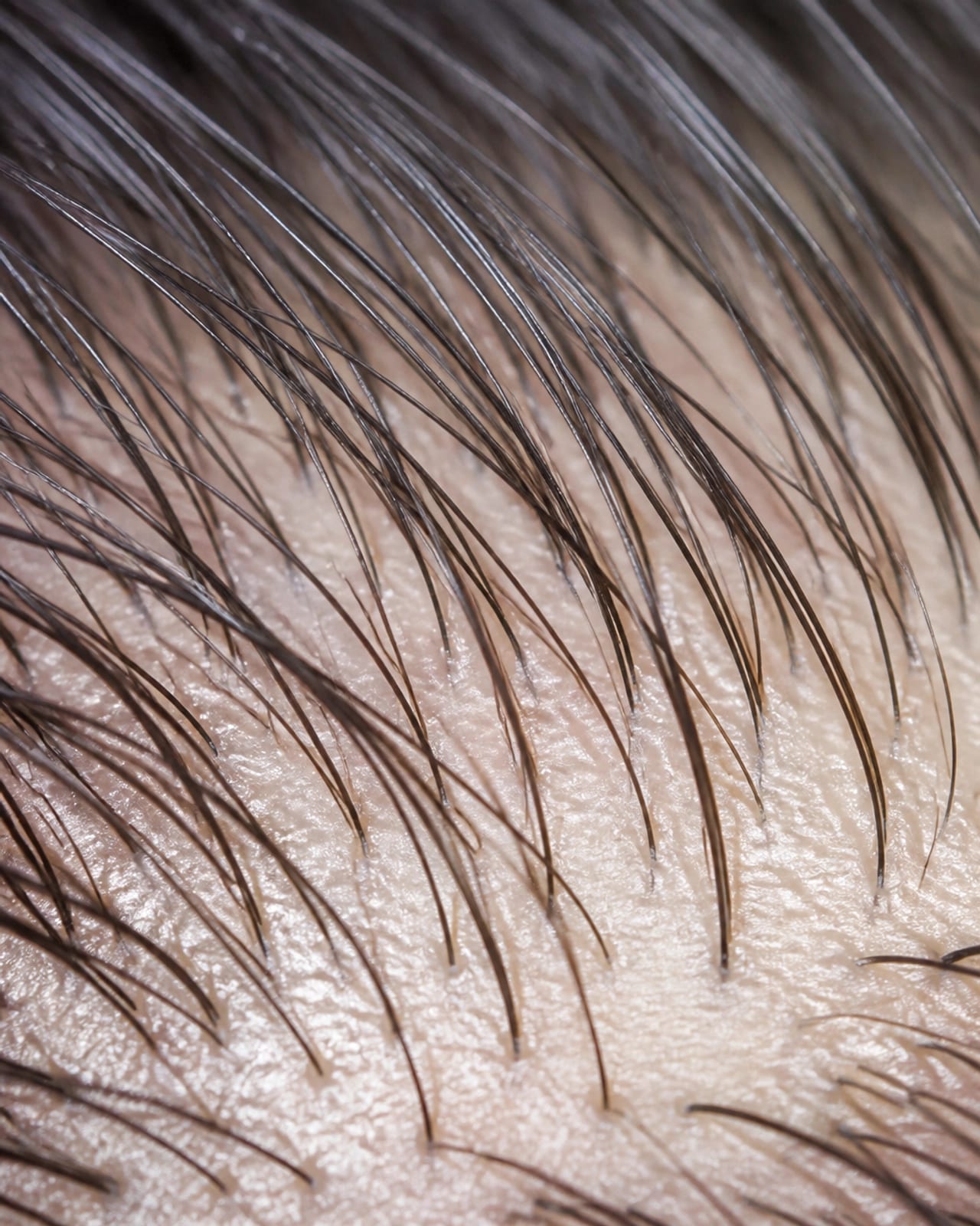 High-density follicle research visualization