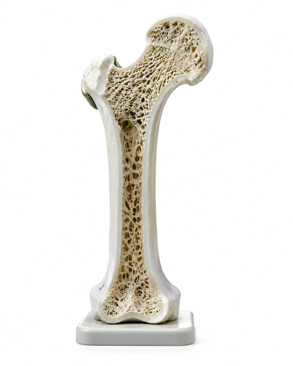 Realistic bone cross-section model showing cortical and trabecular structure